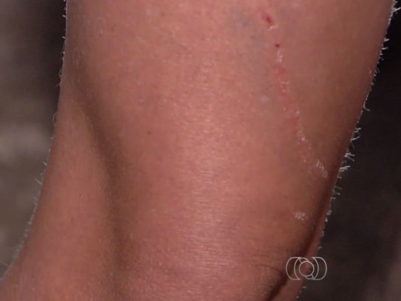 G1 Goiás