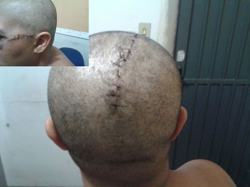 (Foto: Divulgação/SSP-TO)